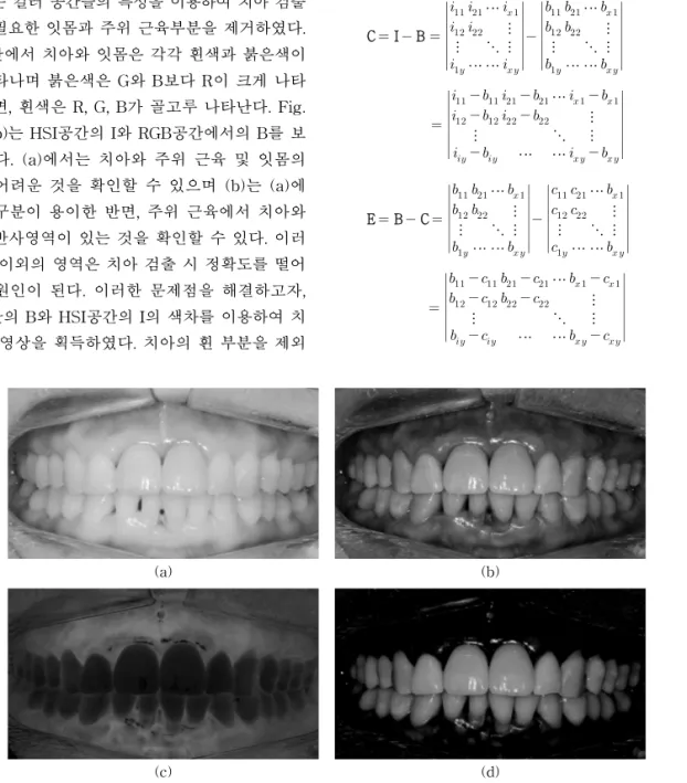 Fig. 2. Emphasized tooth image, (a) I of HSI space, (b) B of RGB space, (c) C of eq. (1), (d) E of eq