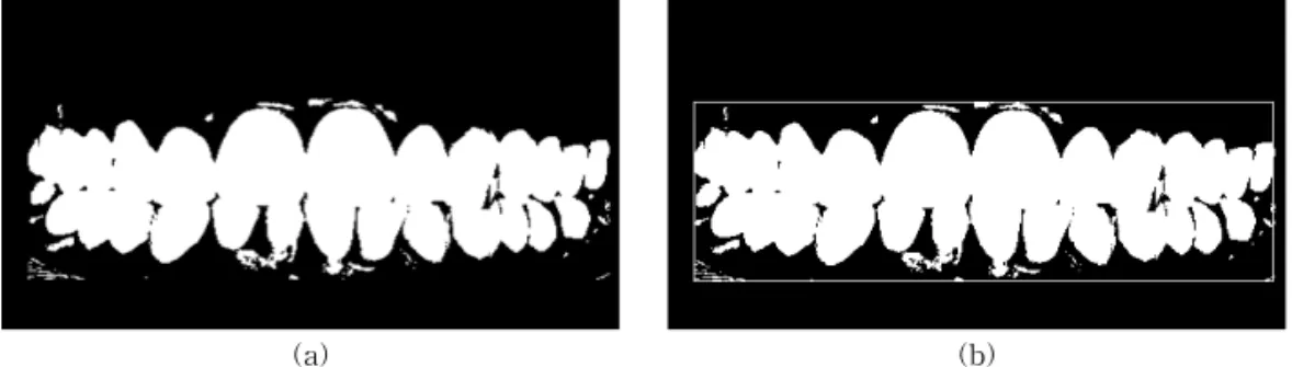 Fig. 4. (a) Width according to tooth type and (b) tooth region division.