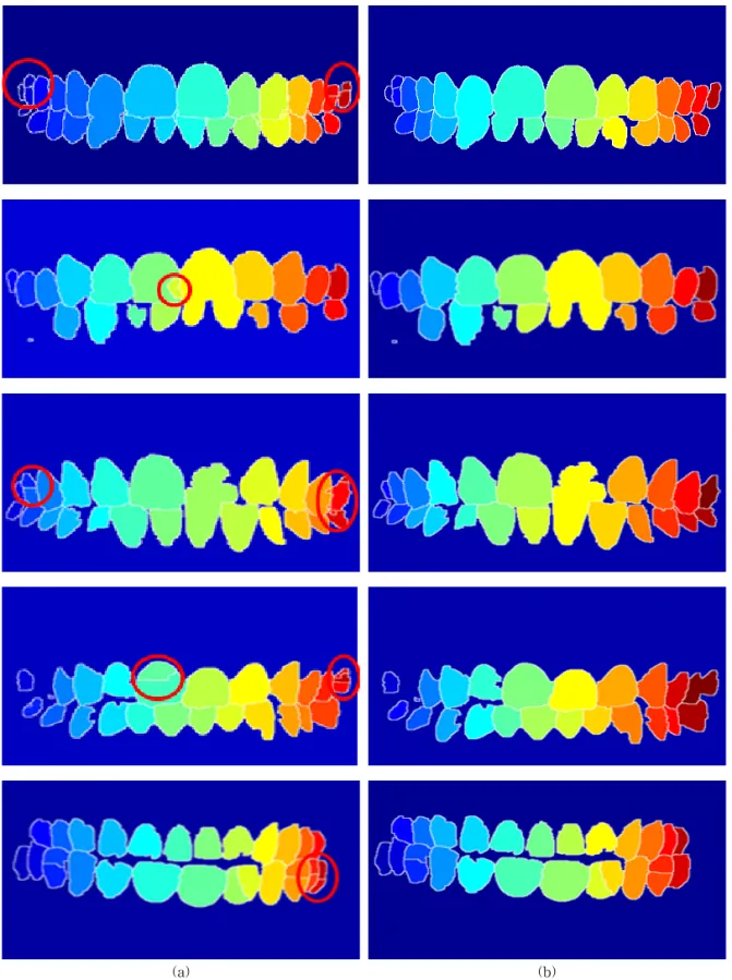 Fig. 9. Tooth segmentation result, (a) marker controlled watershed algorithm results, and (b) the proposed method  results.