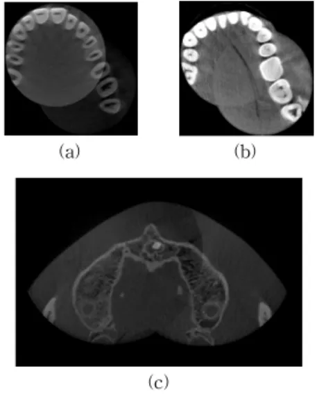 Fig. 2. Cases of problems of previous methods. 