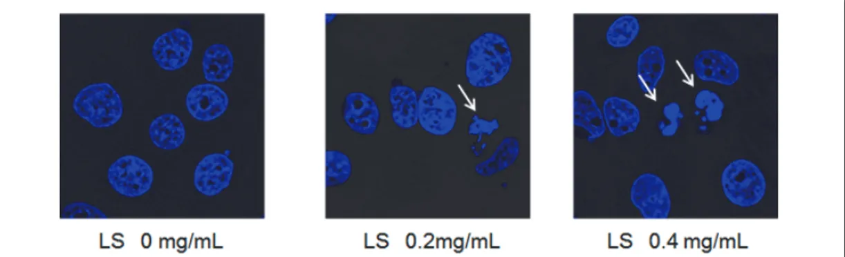 Fig.  2.  An  apoptotic  body  (arrow)  in  MCF-7  breast  cancer  cells  after  treatment  with  LS  extract