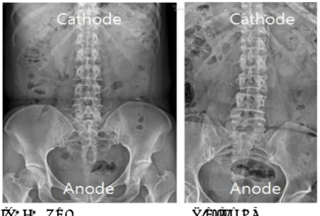 Fig. 10. Mandible townes         Skull townes 