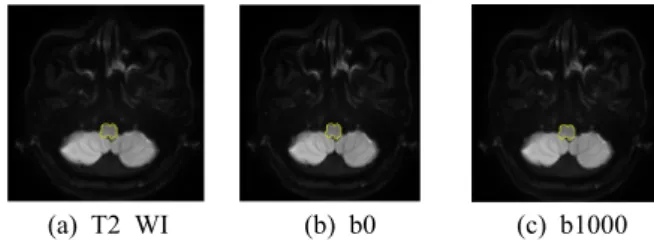 Fig. 1. ROI for measuring the distortion.