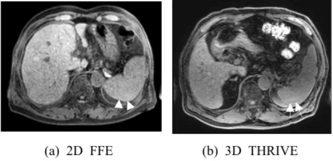 Fig. 3. 2D FFE(a) and 3D THRIVE(b) images  showing Truncation artifact.