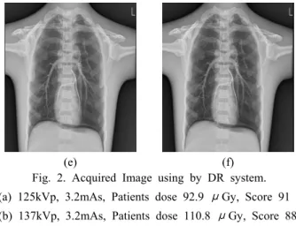 Fig. 2. Acquired Image using by DR system.