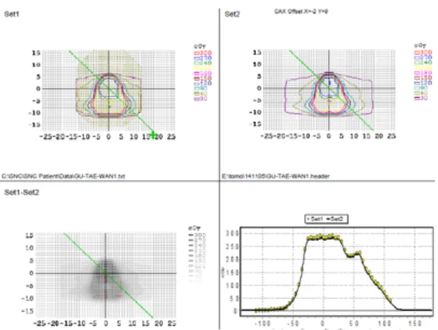 Fig.  5.  MapCHECK2  QA  of  dose  distribution  :  Tomotherapy.
