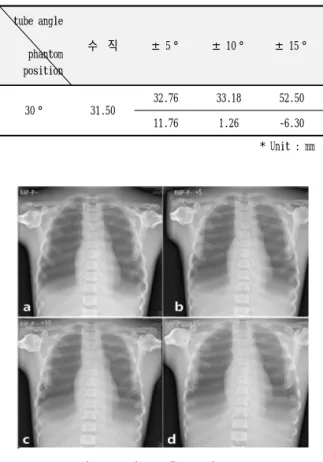Fig.  2.  Example  images  of  30  degree.