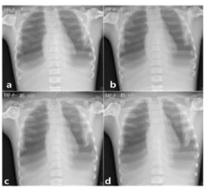 Fig.  3.  Example  Images  of  45  degree.