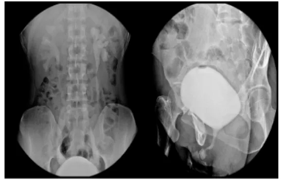 Fig.  1.  VCUG  image.