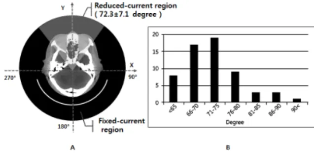 Fig.  1.  A;  Illustration  of  a  new  organ-based  tube  current  modulation.  B;  Histogram  of  eye  lens  range.