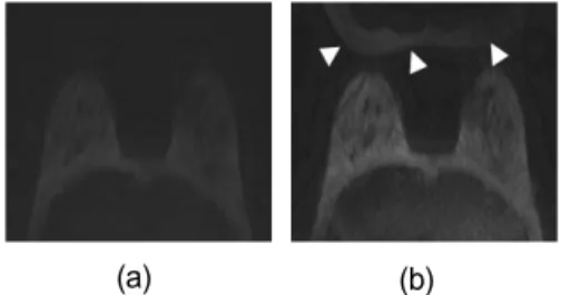 Table  5.  Result  of  quantitative  evaluation  of  normals  and  lesion  area  in  DWI
