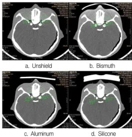 Fig. 2. CT Number and Noise.