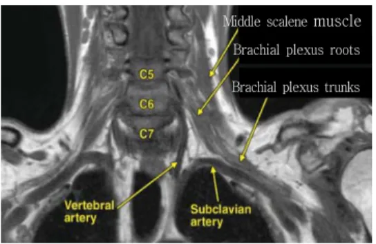 Fig.  1.  Coronal  T1-weighted  MR  image  obtained  in  a  patient  with  head  and  neck  cancer  shows  the  anatomy  of 