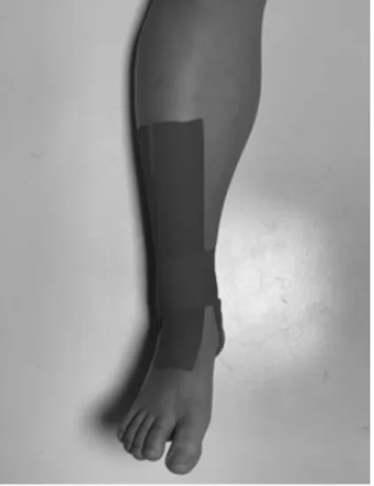 Fig. 1. Joint stabilization taping.