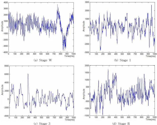 Fig. 2. Different EEG signals.