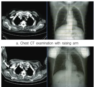 Table  1.  Chest  CT  examination  in  year  2012