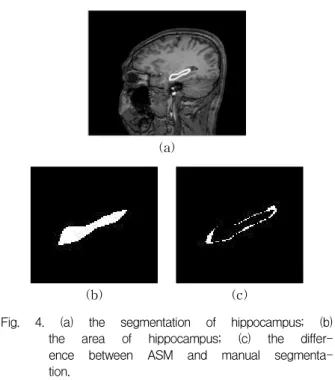 Fig. 4. (a) the segmentation of hippocampus; (b) the area of hippocampus; (c) the  differ-ence between ASM and manual  segmenta-tion.