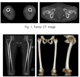 Fig.  2.  Femur  MPR,  VR  Image　
