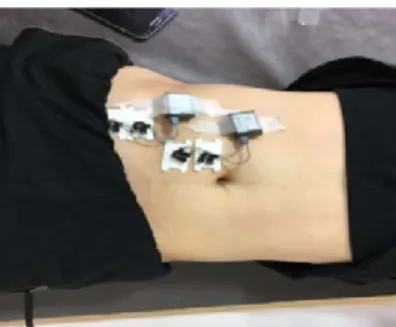 Fig. 1. Wireless surface electromyography Fig. 2. Attaching position of surface electrode