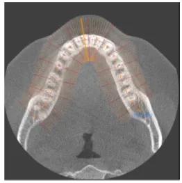 Fig 2. Arch Form by the Patient