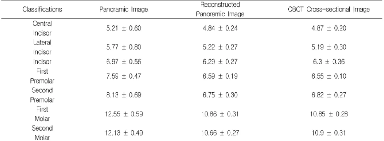 Fig 6. Change in the Distortion Rate depending on the Type of Tooth by Radiography Ⅳ.  고 찰 치과에서 최근 적용되고 있는 새로운 영상화 기법 인 CBCT는 고해상도의 영상과 위치 정보를 제공한다