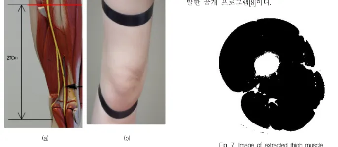 Fig. 7. Image of extracted thigh muscle