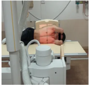Fig. 2. AP Position