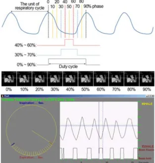 Fig.  3.  Measured  the  diaphragm  motion  and  recording  value  at  the  respiratory  phase,  respectively.