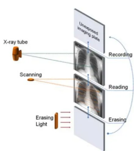 Figure  1.  Block  diagram  shows  the  imaging  plate  (IP)  processing  of  general  computed  radiography  (CR)  system.