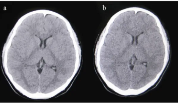 Table  5.  Difference  of  image  quality  of  Helical  scan  image  with  Normal  scan  image