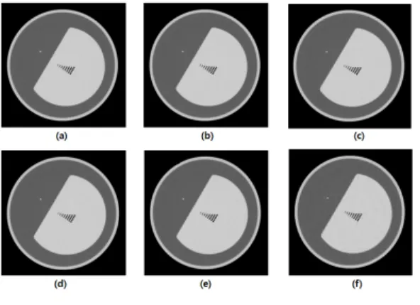 Fig.  9.  Spatial  resolution  measurement  for  compressed  Images 공간  분해능  영상의  압축에  따른  화질변화를  인지 하는  압축률은  15:1에서  3명, 20:1에서  2명이  영상의  변 화를  인지할  수  있다고  대답했다