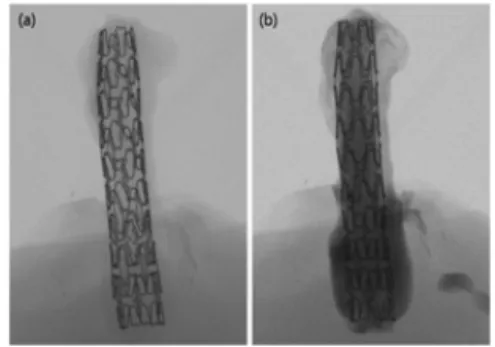 Fig.  1.  The  images  of  stent  harvested  at  4  weeks  post-implantation  with  rabbit  iliiac  arteries  (a)  and  contrast 