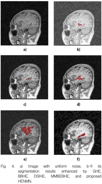 Fig. 4. a) Image with uniform noise, b-f) its segmentation results enhanced by GHE, BBHE, DSIHE, MMBEBHE, and proposed HENMN.