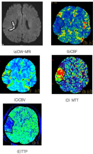 Table  3.  Area  of  lesion  which  is  aquaired  with  image  J 