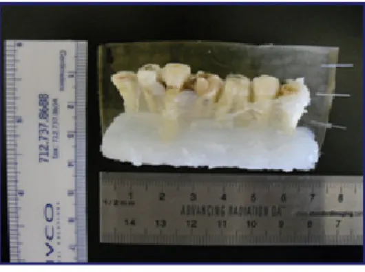 그림  5.  제작된  치아  팬텀 Fig.  5.  Fabricated  teeth  phantom