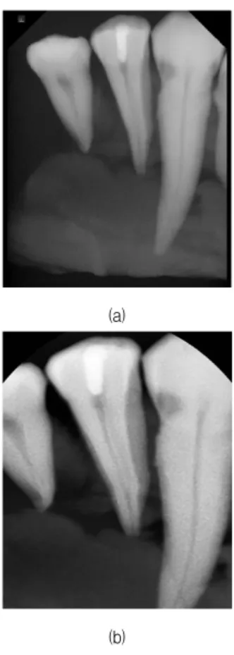 Fig.  8.  Acquired  phantom  image  (a)  Phantom  image  using  Trophy  tube  &amp;  kodak  detector  (b)  Phantom  image  using 