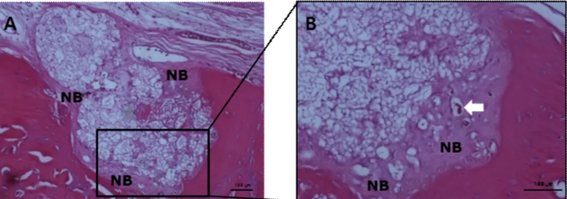 Figure 5. Histological sections of 8 mm critical-sized calvarial defect of the β-TCP grafted group  (A and B)
