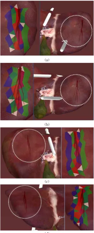 그림 9. 기존 기법들과의 비교 (a) Müller et al.[6] (b) Andersson et al.[8] (c) Daenzer et al.[9]