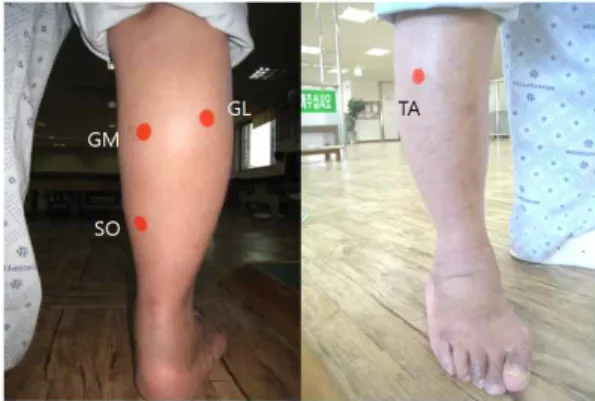 Figure  7.  Locations  of  sEMG  electrodes  attachment.