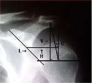 Fig  1.  Quantitative  radiographic  measurements