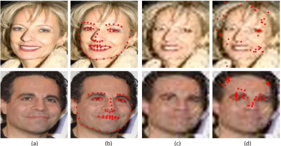 Fig. 1. Comparison of landmark estimation results between high-resolution images (GT) and low-resolution (LR) images