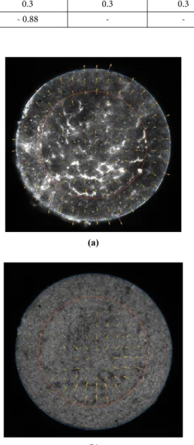 Fig. 5. Modeling of a dental restoration ring models for 3D finite element calculation 