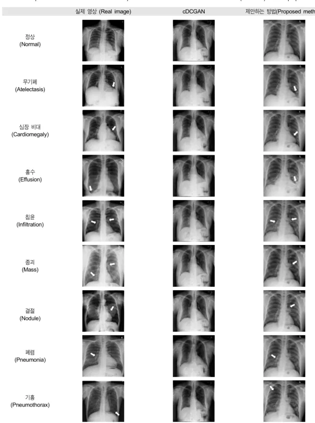 Table 2. Comparison of results with conditional Deep Convolution Generative Adversarial Network (cDCGAN) and the proposed method