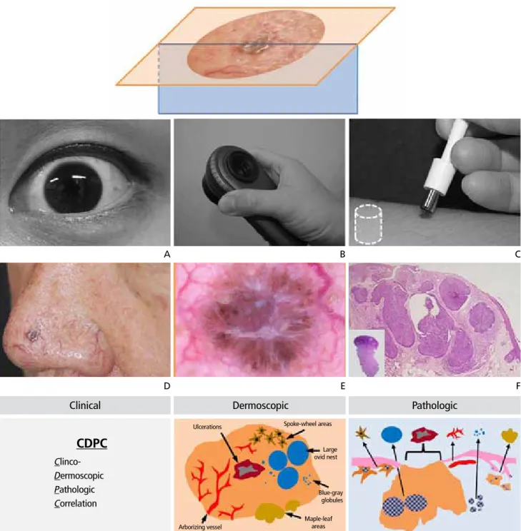 Figure 1.  Overview on the dermoscopy. (1st row) Skin lesions are usually approached in two ways