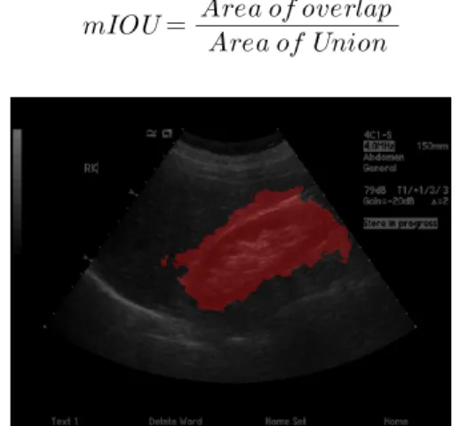 Fig.  2.  Found  area