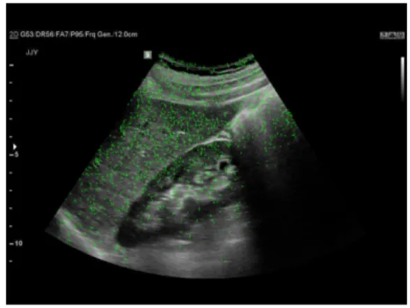 Fig.  1.  Image  of  removing  values  less  than  0.03.