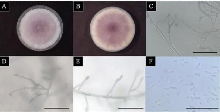 Figure 2. Mycological characteristics of the isolate from Allium tuberosum .