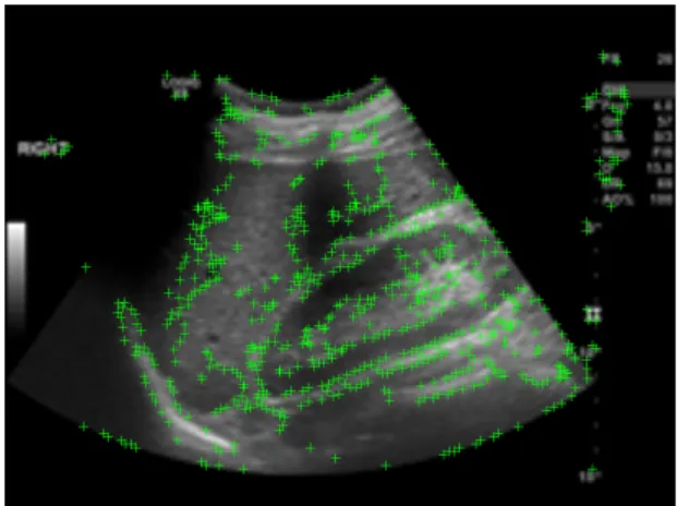 Fig.  4.  Apply  the  SIFT  algorithm  to  the  obtained  image  to  display  the  feature  points  on  the  original  image