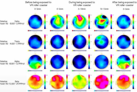 Fig.  11.  Visualization  of  changes  in  EEG  spectrum  data  for  a  representative  FG  subject  before,  during,  and  after  being  exposed  to  VR  roller  coaster content: Note that theta power at frontal sites increases and alpha power decreases a
