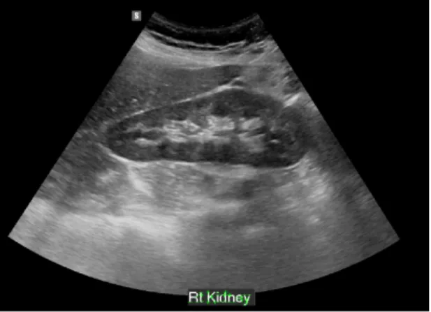 Fig.  4.  Ultrasound  image  adapting  Harris  corner  algorithm